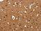 Integrin Linked Kinase antibody, CSB-PA941698, Cusabio, Immunohistochemistry frozen image 