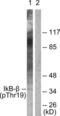 NFKB Inhibitor Beta antibody, LS-C199100, Lifespan Biosciences, Western Blot image 