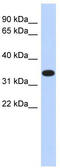 Actin Related Protein T1 antibody, TA340281, Origene, Western Blot image 