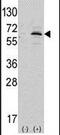 NEDD8 Activating Enzyme E1 Subunit 1 antibody, PA5-14141, Invitrogen Antibodies, Western Blot image 