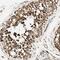Zinc Finger Protein 443 antibody, NBP1-80599, Novus Biologicals, Immunohistochemistry paraffin image 