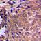 Protein Kinase C Zeta antibody, orb214448, Biorbyt, Immunohistochemistry paraffin image 