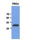 SBDS Ribosome Maturation Factor antibody, GTX53781, GeneTex, Western Blot image 