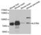 Interleukin 31 Receptor A antibody, LS-C334518, Lifespan Biosciences, Western Blot image 