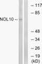 Nucleolar Protein 10 antibody, PA5-39317, Invitrogen Antibodies, Western Blot image 