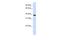 Glycerol-3-phosphate dehydrogenase 1-like protein antibody, A07912, Boster Biological Technology, Western Blot image 