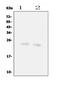 Fibroblast Growth Factor 22 antibody, PA1455, Boster Biological Technology, Western Blot image 