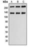 Myosin light chain kinase, smooth muscle antibody, MBS822161, MyBioSource, Western Blot image 