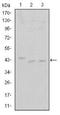 Cyclin Dependent Kinase 9 antibody, NBP2-37600, Novus Biologicals, Western Blot image 