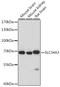 Sodium-dependent phosphate transport protein 2C antibody, A06557, Boster Biological Technology, Western Blot image 