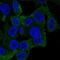 TACO antibody, NBP2-13861, Novus Biologicals, Immunocytochemistry image 