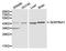 Alpha-1-antitrypsin antibody, A00720, Boster Biological Technology, Western Blot image 