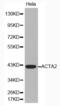 Actin Alpha 2, Smooth Muscle antibody, abx000075, Abbexa, Western Blot image 