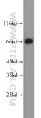 Alpha Fetoprotein antibody, 14550-1-AP, Proteintech Group, Western Blot image 