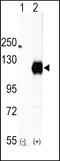 EPH Receptor A2 antibody, 63-039, ProSci, Western Blot image 