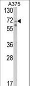 Solute carrier family 23 member 2 antibody, LS-C161170, Lifespan Biosciences, Western Blot image 