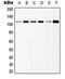 Glutamate Metabotropic Receptor 6 antibody, LS-C352294, Lifespan Biosciences, Western Blot image 