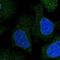 Diacylglycerol Kinase Eta antibody, NBP1-85228, Novus Biologicals, Immunofluorescence image 