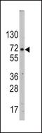 Solute Carrier Family 2 Member 2 antibody, PA5-11567, Invitrogen Antibodies, Western Blot image 