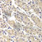 DNA Fragmentation Factor Subunit Alpha antibody, A1032, ABclonal Technology, Immunohistochemistry paraffin image 