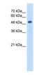 Solute Carrier Family 1 Member 5 antibody, ab58690, Abcam, Western Blot image 