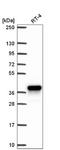 Aldo-Keto Reductase Family 1 Member C1 antibody, NBP2-57667, Novus Biologicals, Western Blot image 