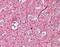 Keratin 5 antibody, orb95705, Biorbyt, Immunohistochemistry paraffin image 