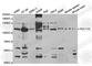 BAF Chromatin Remodeling Complex Subunit BCL11A antibody, A5445, ABclonal Technology, Western Blot image 
