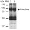 Sodium Channel Epithelial 1 Beta Subunit antibody, LS-C777195, Lifespan Biosciences, Western Blot image 