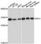 Isoamyl Acetate Hydrolyzing Esterase 1 (Putative) antibody, A13710, ABclonal Technology, Western Blot image 