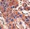 Bone Morphogenetic Protein Receptor Type 1A antibody, LS-C97653, Lifespan Biosciences, Immunohistochemistry paraffin image 