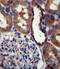 Glutamate Ionotropic Receptor Kainate Type Subunit 3 antibody, abx027218, Abbexa, Immunohistochemistry paraffin image 