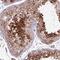 Centriolar Coiled-Coil Protein 110 antibody, NBP2-49013, Novus Biologicals, Immunohistochemistry frozen image 