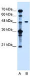 Solute Carrier Family 39 Member 6 antibody, TA334104, Origene, Western Blot image 