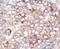 Phosphoinositide-3-Kinase Regulatory Subunit 4 antibody, PA5-15265, Invitrogen Antibodies, Immunohistochemistry paraffin image 