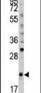 BH3 Interacting Domain Death Agonist antibody, PA5-11384, Invitrogen Antibodies, Western Blot image 