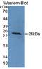 Protein Tyrosine Phosphatase Receptor Type A antibody, LS-C703562, Lifespan Biosciences, Western Blot image 