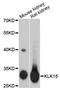 Kallikrein Related Peptidase 15 antibody, A2757, ABclonal Technology, Western Blot image 
