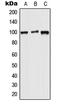 Wolframin ER Transmembrane Glycoprotein antibody, LS-C353000, Lifespan Biosciences, Western Blot image 