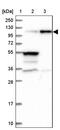 Zinc Finger Protein 598 antibody, PA5-59777, Invitrogen Antibodies, Western Blot image 