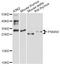 Proteasome Subunit Alpha 8 antibody, LS-C749370, Lifespan Biosciences, Western Blot image 