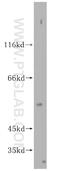 Spermatogenesis Associated Serine Rich 2 Like antibody, 16938-1-AP, Proteintech Group, Western Blot image 