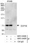 Decapping MRNA 1B antibody, NBP2-04008, Novus Biologicals, Immunoprecipitation image 
