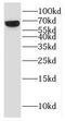 Guanine Monophosphate Synthase antibody, FNab03529, FineTest, Western Blot image 