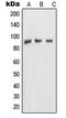Nucleoporin 88 antibody, LS-C352603, Lifespan Biosciences, Western Blot image 