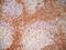 CD7 Molecule antibody, GTX74731, GeneTex, Immunohistochemistry frozen image 