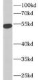 Interferon Induced Protein With Tetratricopeptide Repeats 1 antibody, FNab04135, FineTest, Western Blot image 