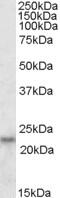 Interleukin 18 antibody, TA305919, Origene, Western Blot image 