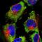 Fragile X Mental Retardation 1 antibody, NBP2-38617, Novus Biologicals, Immunofluorescence image 