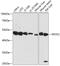 Eukaryotic Translation Initiation Factor 2 Subunit Beta antibody, 15-573, ProSci, Western Blot image 